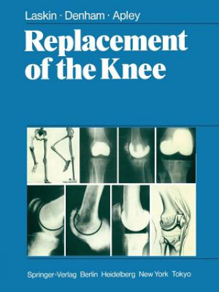 Książka Replacement of the Knee R.S. Laskin