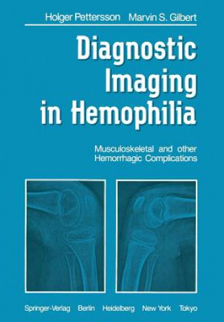 Kniha Diagnostic Imaging in Hemophilia H. Pettersson