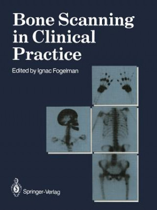 Könyv Bone Scanning in Clinical Practice Ignac Fogelman