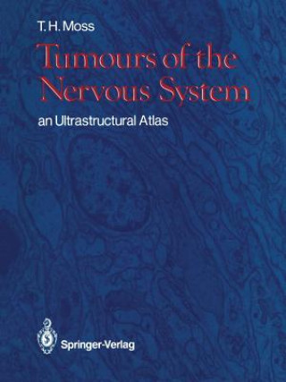 Könyv Tumours of the Nervous System Timothy H. Moss