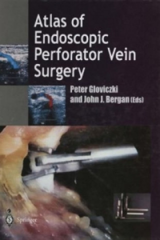 Könyv Atlas of Endoscopic Perforator Vein Surgery Peter Gloviczki