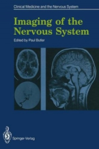 Libro Imaging of the Nervous System Paul Butler