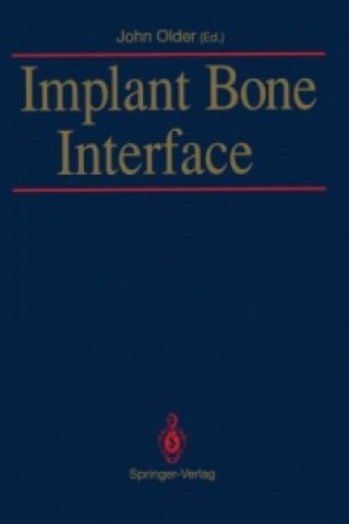 Livro Implant Bone Interface John Older