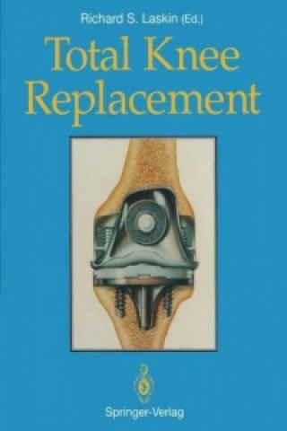 Kniha Total Knee Replacement Richard S. Laskin