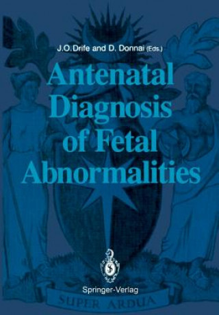 Carte Antenatal Diagnosis of Fetal Abnormalities James O. Drife