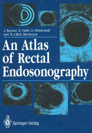 Kniha Atlas of Rectal Endosonography John Beynon