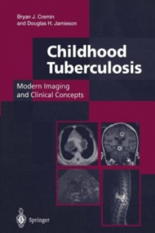 Carte Childhood Tuberculosis: Modern Imaging and Clinical Concepts Bryan J. Cremin