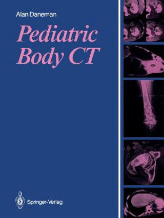 Könyv Pediatric Body CT Alan Daneman