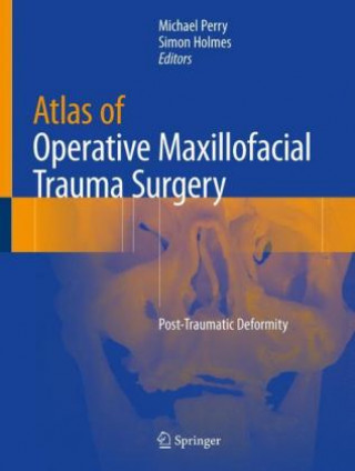 Knjiga Atlas of Operative Maxillofacial Trauma Surgery Michael John Perry