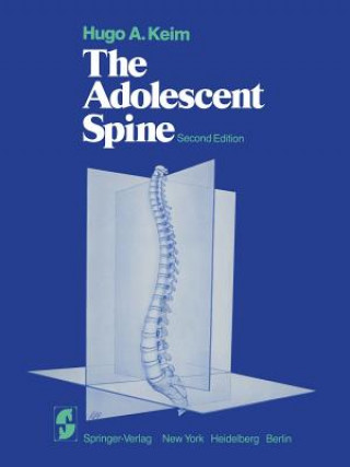 Kniha Adolescent Spine H.A. Keim