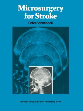 Kniha Microsurgery for Stroke P. Schmiedek