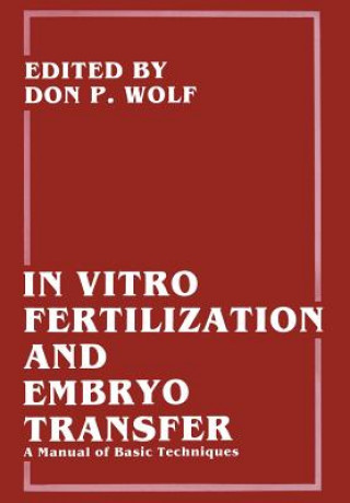 Carte In Vitro Fertilization and Embryo Transfer Don P. Wolf