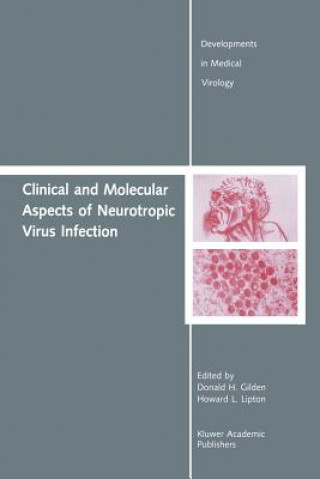 Carte Clinical and Molecular Aspects of Neurotropic Virus Infection Donald H. Gilden