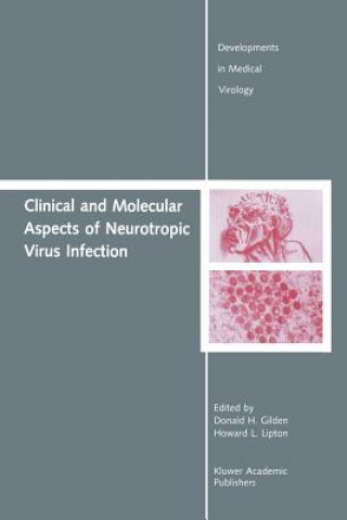 Kniha Clinical and Molecular Aspects of Neurotropic Virus Infection Donald H. Gilden