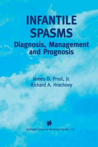 Knjiga Infantile Spasms James D. Frost Jr.