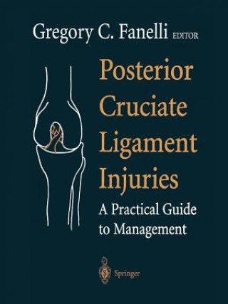 Carte Posterior Cruciate Ligament Injuries Gregory C. Fanelli