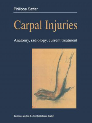 Kniha Carpal injuries Philippe Saffar