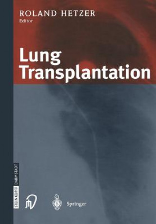 Kniha Lung Transplantation R. Hetzer