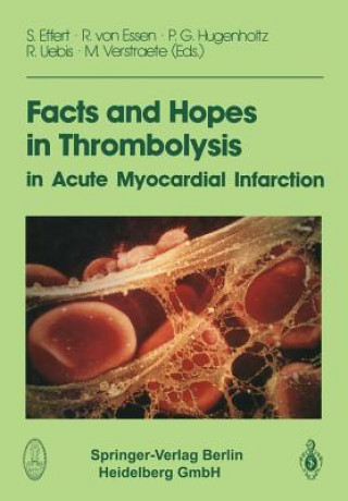 Kniha Facts and Hopes in Thrombolysis in Acute Myocardial Infarction S. Effert