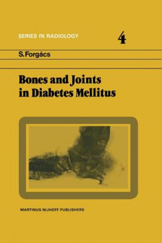 Kniha Bones and Joints in Diabetes Mellitus S. Forgács