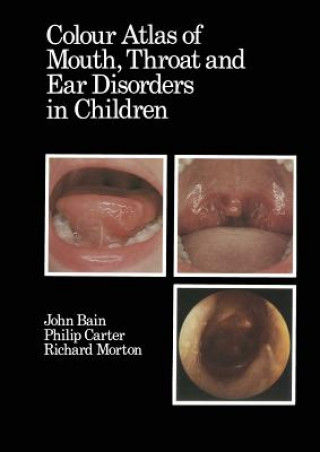 Carte Colour Atlas of Mouth, Throat and Ear Disorders in Children D.J. Bain