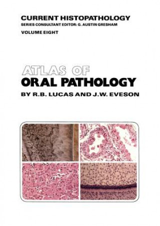 Könyv Atlas of Oral Pathology R.B. Lucas