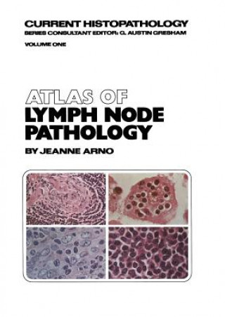 Kniha Atlas of Lymph Node Pathology J. Arno