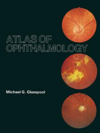 Kniha Atlas of Ophthalmology M.G. Glasspool