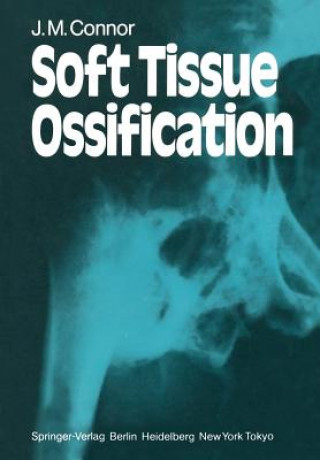 Knjiga Soft Tissue Ossification J. M. Connor