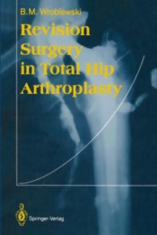 Buch Revision Surgery in Total Hip Arthroplasty Boguslaw M. Wroblewski