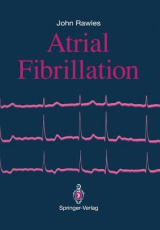 Kniha Atrial Fibrillation John Rawles