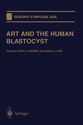 Carte ART and the Human Blastocyst David K. Gardner
