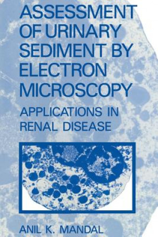 Könyv Assessment of Urinary Sediment by Electron Microscopy A.K. Mandal