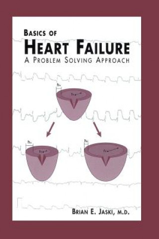 Carte Basics of Heart Failure Brian E. Jaski