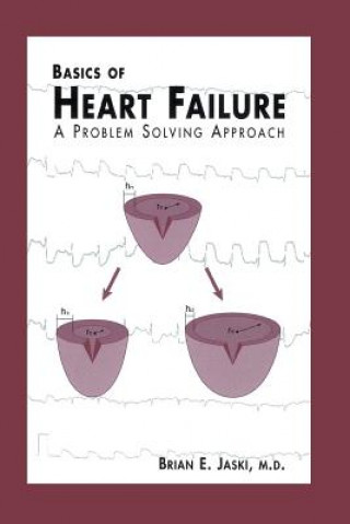 Libro Basics of Heart Failure Brian E. Jaski