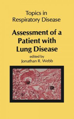 Carte Assessment of a Patient with Lung Disease J.R. Webb