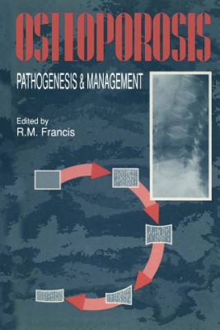 Libro Osteoporosis R.M. Francis