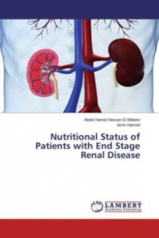 Knjiga Nutritional Status of Patients with End Stage Renal Disease Abdel Hamid Hassan El Bilbeisi