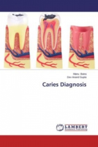 Książka Caries Diagnosis Manu Batra