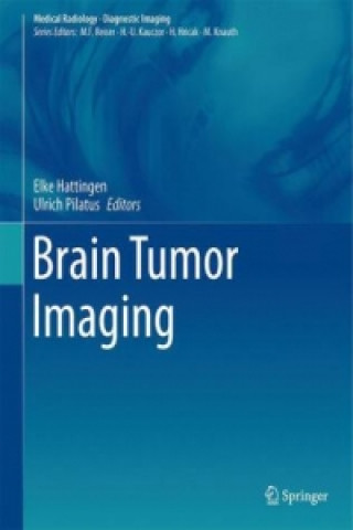 Carte Brain Tumor Imaging Elke Hattingen