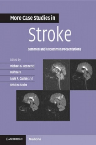Kniha More Case Studies in Stroke Michael Hennerici