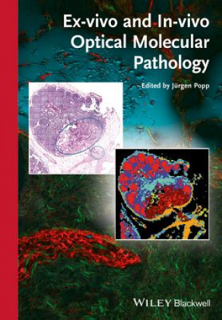 Carte Ex-vivo and In-vivo Optical Molecular Pathology Jürgen Popp