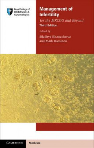 Knjiga Management of Infertility for the MRCOG and Beyond Siladitya Bhattacharya