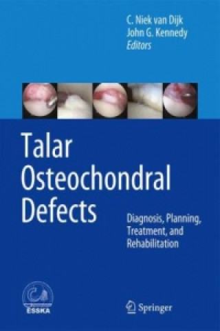 Book Talar Osteochondral Defects C. Niek Dijk