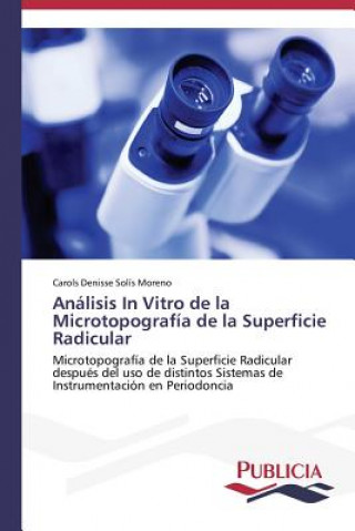 Könyv Analisis In Vitro de la Microtopografia de la Superficie Radicular Carols Denisse Solís Moreno