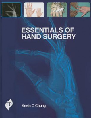 Książka Essentials of Hand Surgery Kevin C Chung