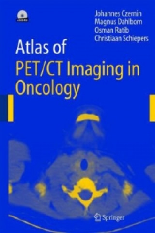 Knjiga Atlas of PET/CT Imaging in Oncology Johannes Czernin