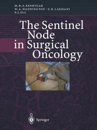 Kniha Sentinel Node in Surgical Oncology Mohammad R.S. Keshtgar
