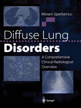 Könyv Diffuse Lung Disorders Miriam Sperber