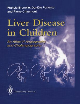 Kniha Liver Disease in Children Francis Brunelle